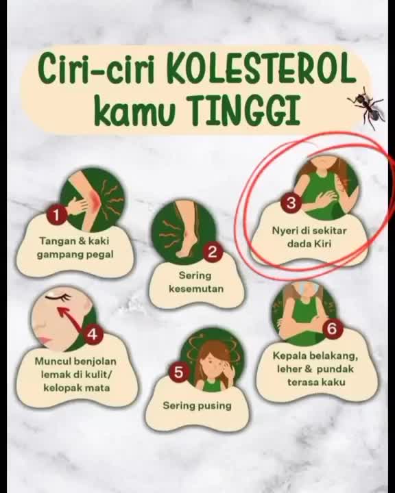 ciri ciri kolesterol kamu tinggi