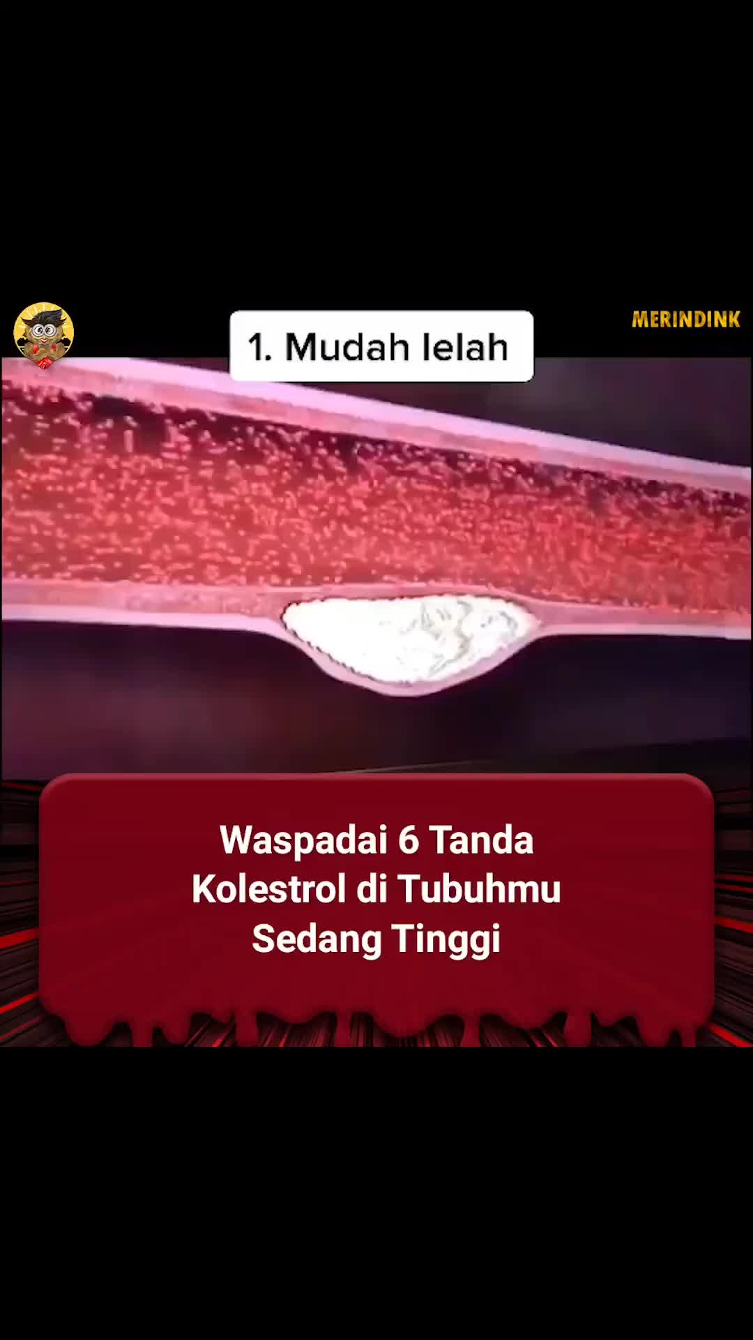 kolesterol ditubuh mu