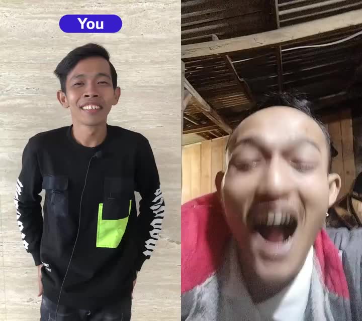 Itu gigi kenapa keluar