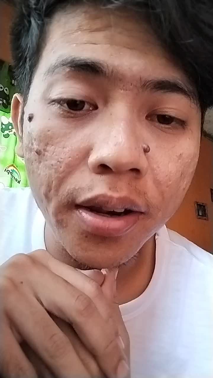 XFI2023 SOLO EGI ERDIANSYAH 28 thn KOTA SUKABI HERE WITHOUT YOU