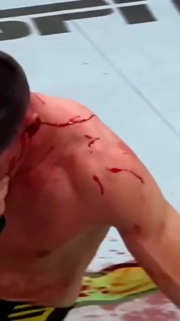 UFC Blood Gore video